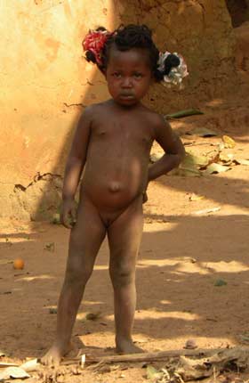 Orpheline du Bénin, sans acte de naissance
